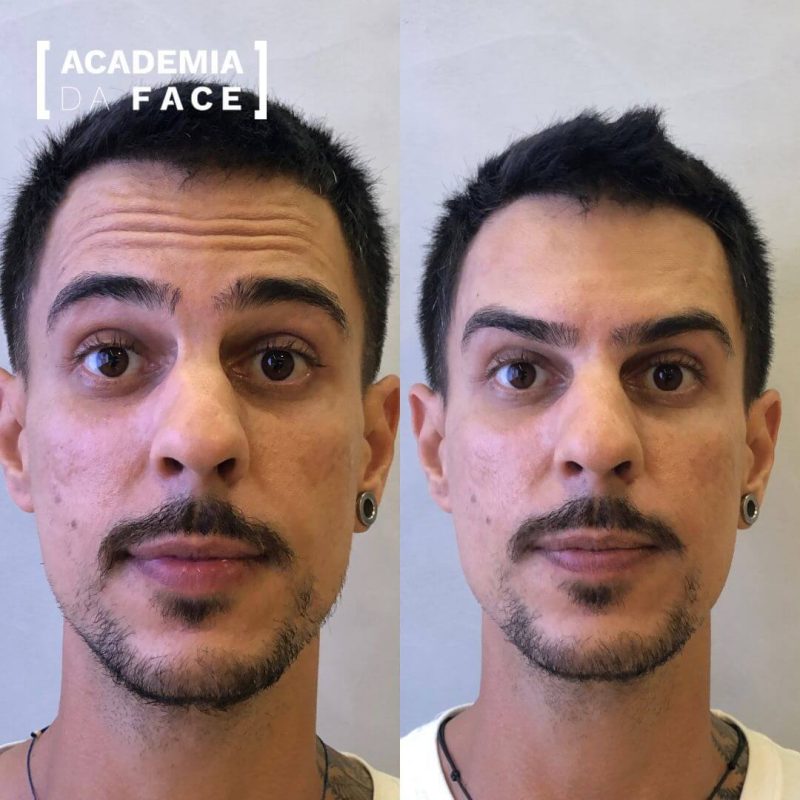 Paciente 1 Salvador 2