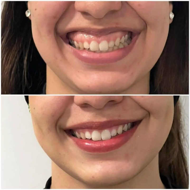 Paciente São Bernardo do Campo